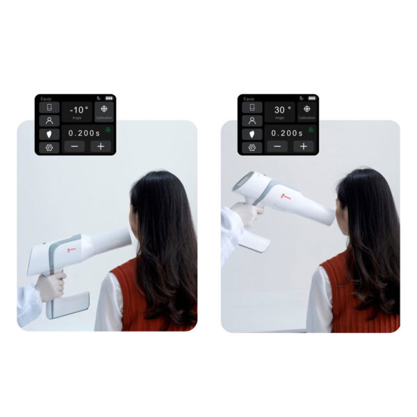 Woodpecker AI RAY (Portable X-RAY) - Image 5