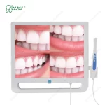 Rixi Dental Intraoral Camera with USB
