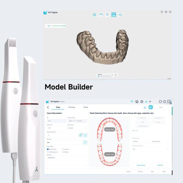 Kevin Peter Smile 2 Intraoral Scanner - Image 5